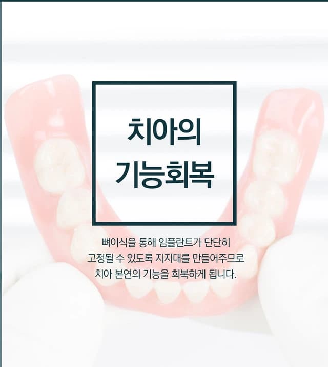치아의 기능회복