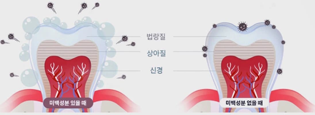 미백 약제의 산소가 착색물질을 제거하는 과정